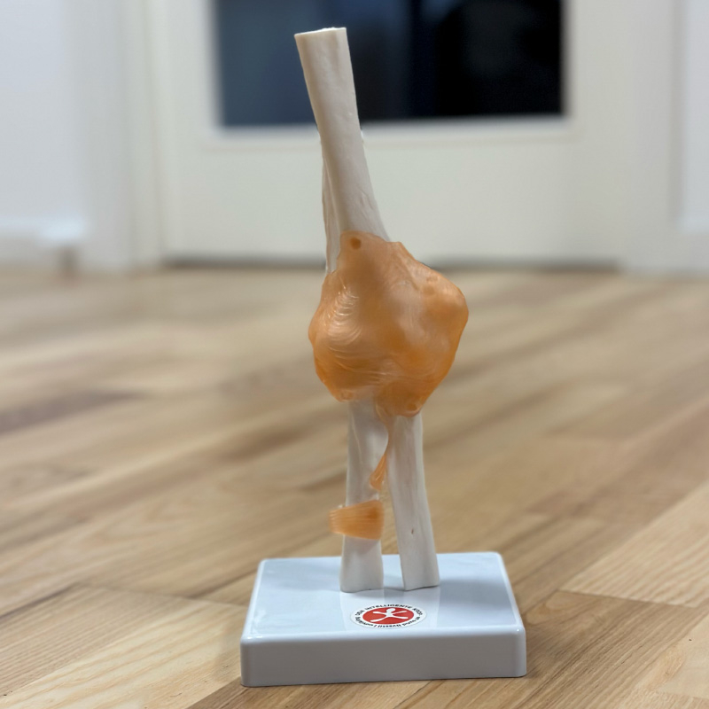 Albueled  Fuld Størrelse